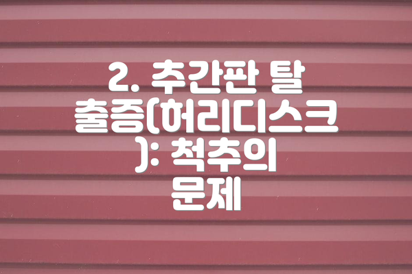 2. 추간판 탈출증(허리디스크): 척추의 문제