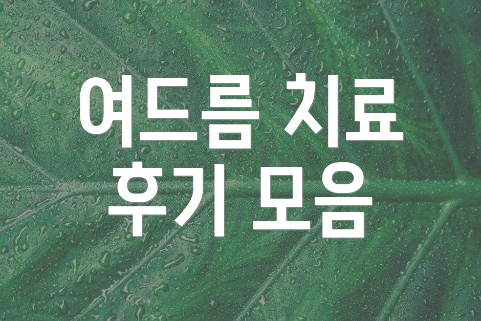여드름 치료 후기 모음